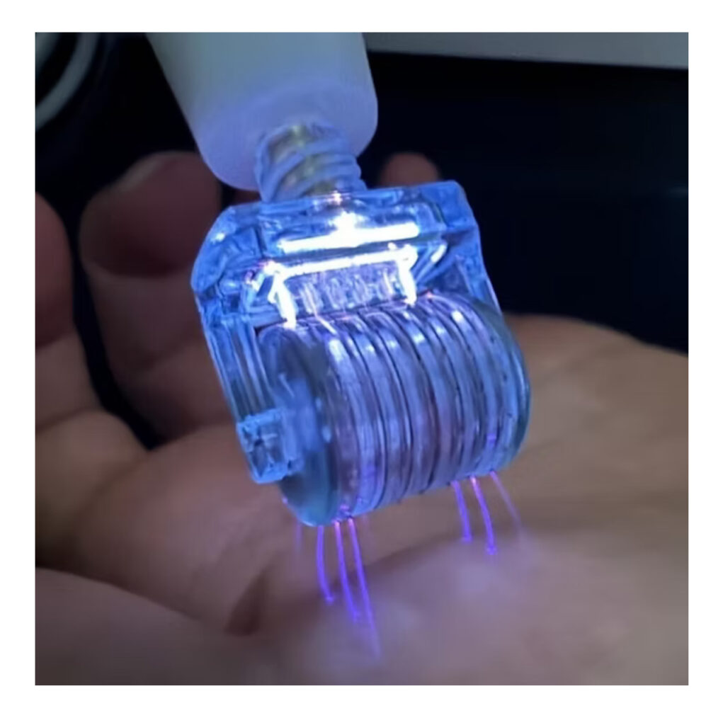 IMG_2459 derma plasma