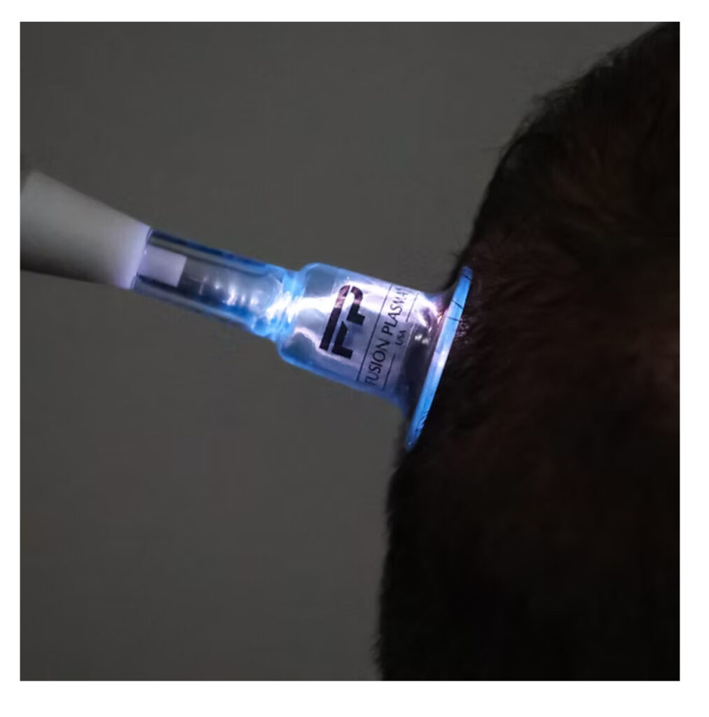 IMG_2461 scalp plasma