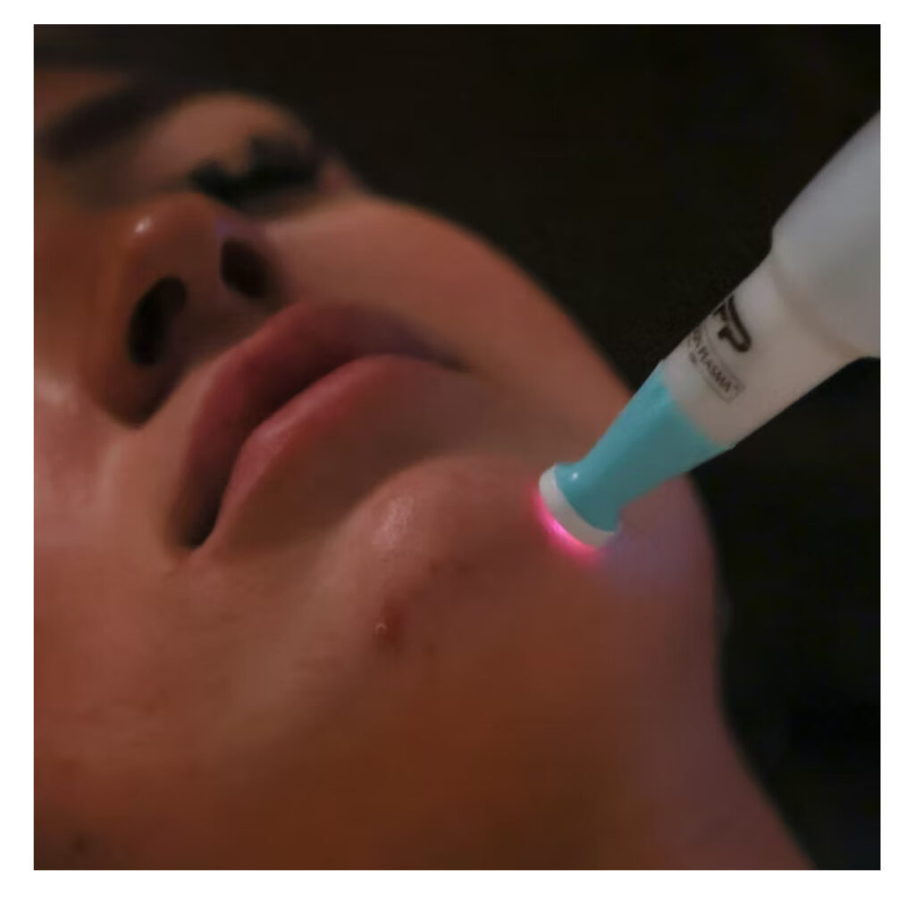 IMG_2465 ozone plasma