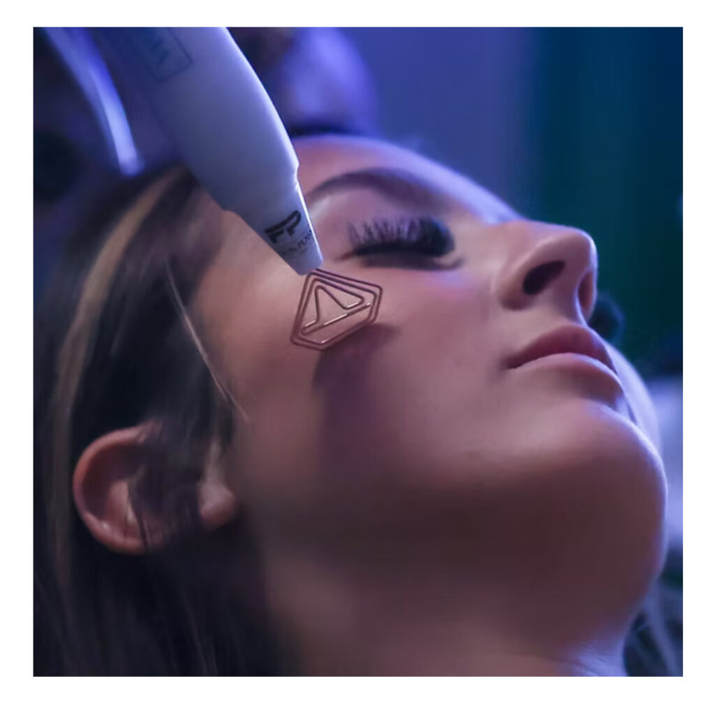 IMG_2467 diamond plasma